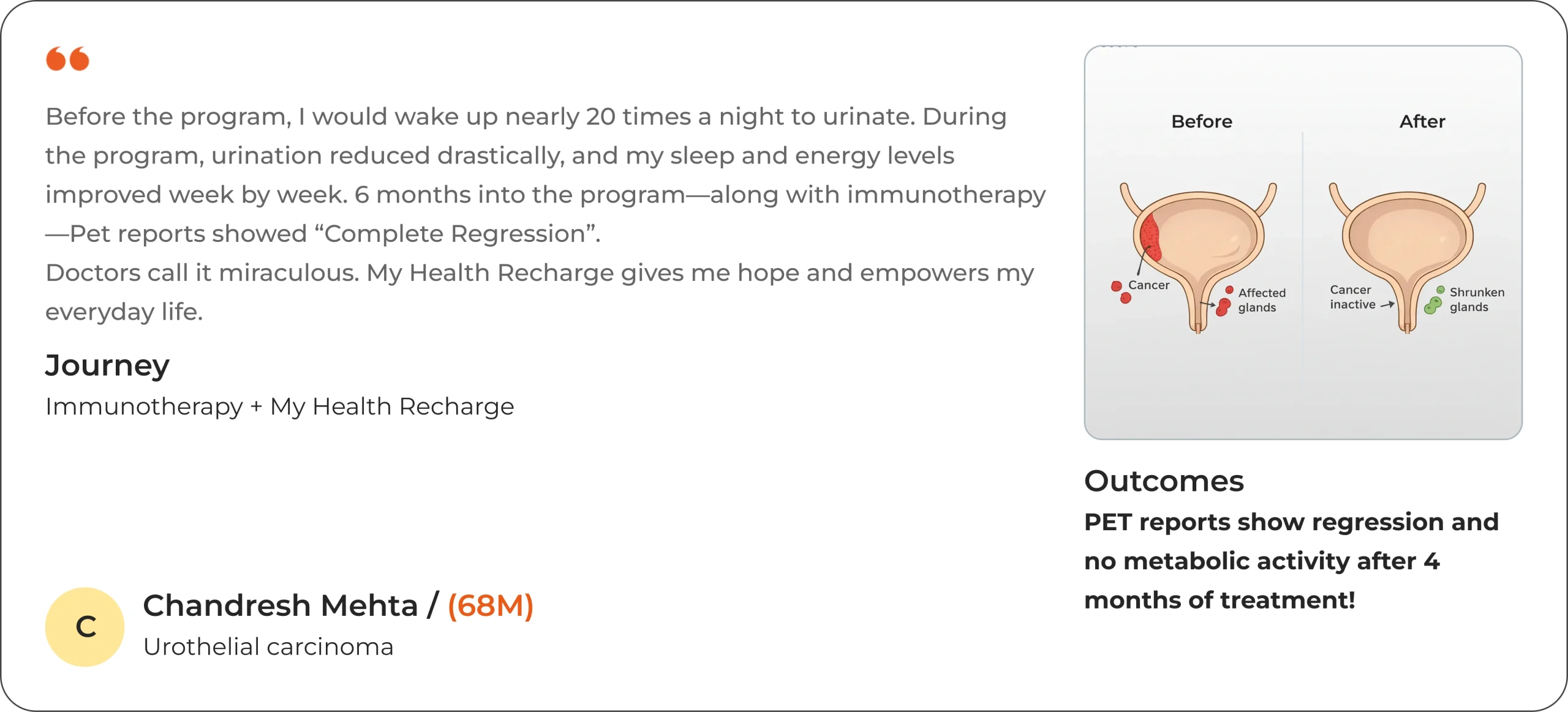 Chandresh Mehta – Urothelial carcinoma